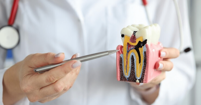 Why Root Canal Treatment in Dubai Is a Tooth-Saver