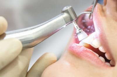 Who Benefits Most from Teeth Whitening Cost in Dubai?