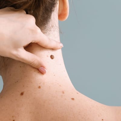 When Is It Ideal to See the Best Dermatologist in Dubai for Anti-Aging?