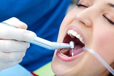 Why Root Canal Treatment in Dubai is Suitable for All Ages