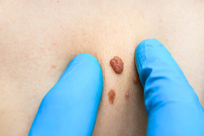 What Advice Does the Best Dermatologist in Dubai Offer for Glow?