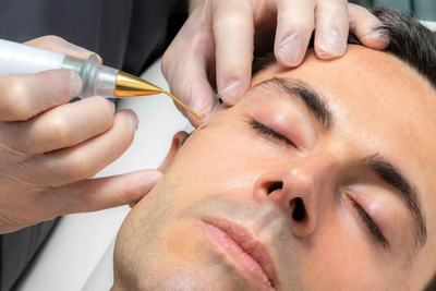 Why Choose Plasma Pen Treatment in Dubai Over Surgery?