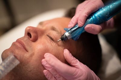 How Quickly Can Plasma Pen Treatment in Dubai Show Results?