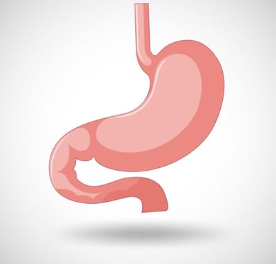 Who Needs Gastric Balloon Placement in Dubai?