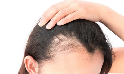 How Do Experts Address Laser Hair Removal Haram Issues?