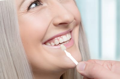 What People thinking About Composite Veneers treatment