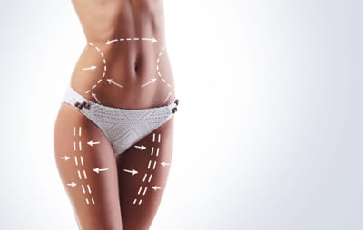 Why Is Liposuction Uae a Popular Cosmetic Choice?