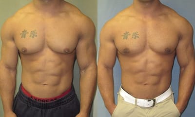 Top Clinics Offering Advanced Gyno Surgery Dubai