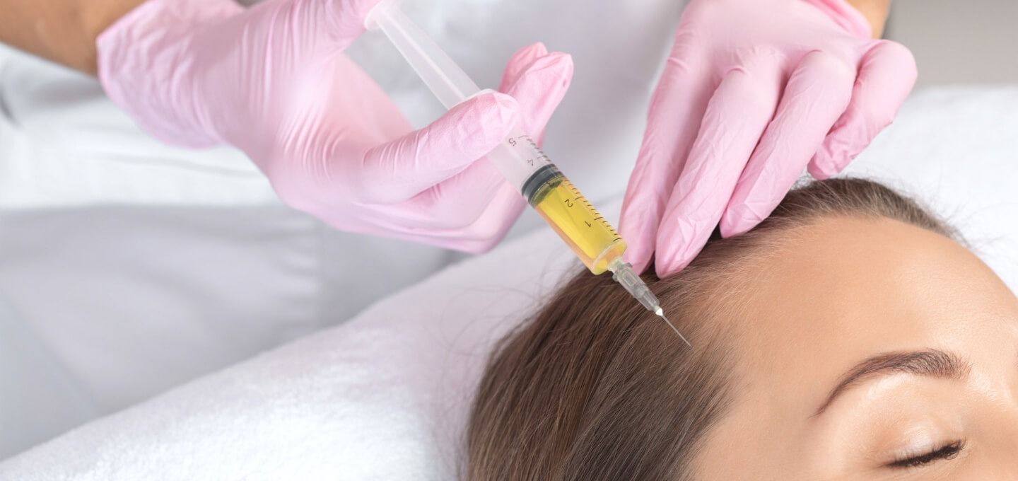 Best PRP Hair Treatment in Dubai