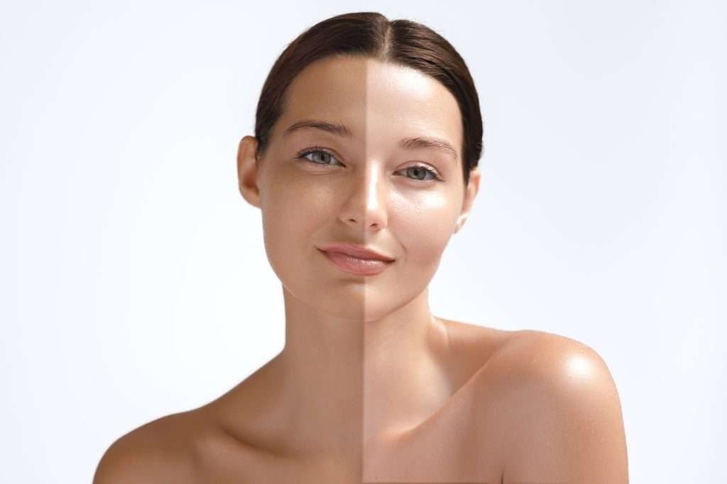 permanent skin whitening injection price in Dubai