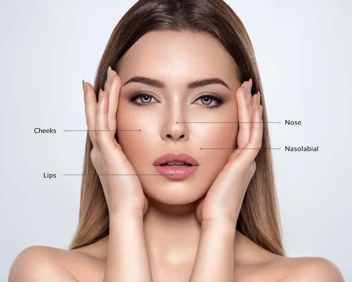 Juvederm Fillers