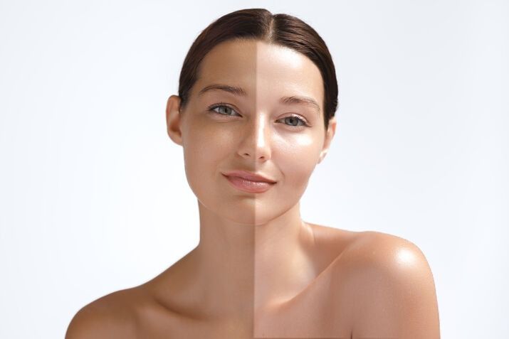 Permanent Skin Whitening Injection