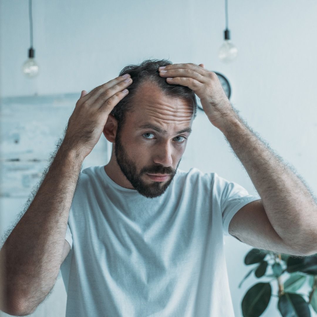 Finasteride 1mg