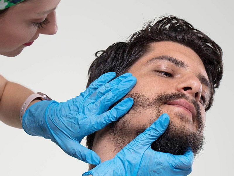 Beard Hair Transplant in Dubai