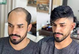 Hair Direct