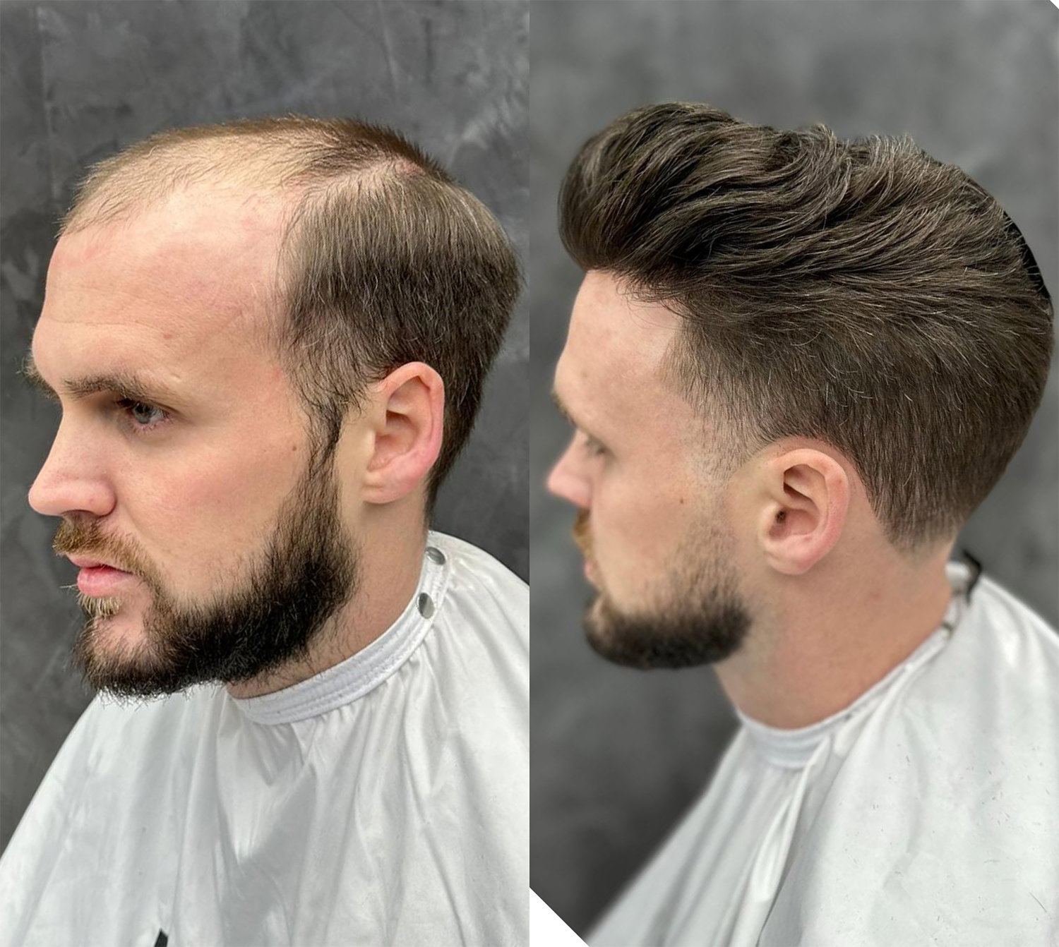 Hair systems for men online in USA