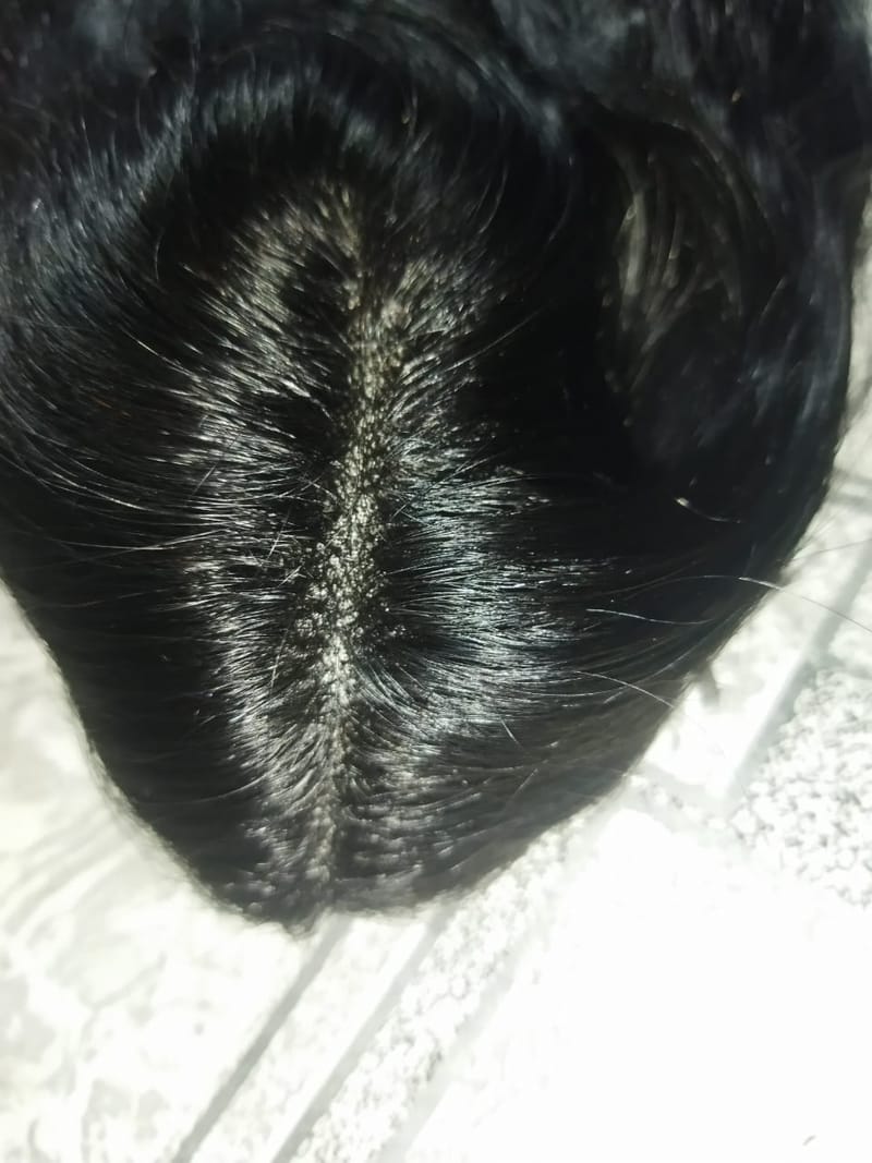 Wig