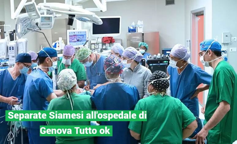 Sorelline siamesi separate con un intervento di altissima complessità