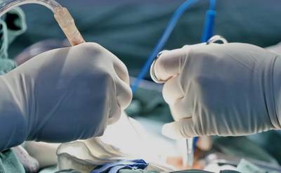 Primo trapianto di vescica umana su un uomo di 41 anni