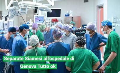 Sorelline siamesi separate con un intervento di altissima complessità