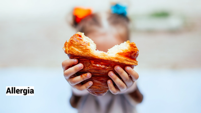 Allergia choc per una bambina di 1 anno e mezzo dopo aver mangiato una brioche al bar della spiaggia