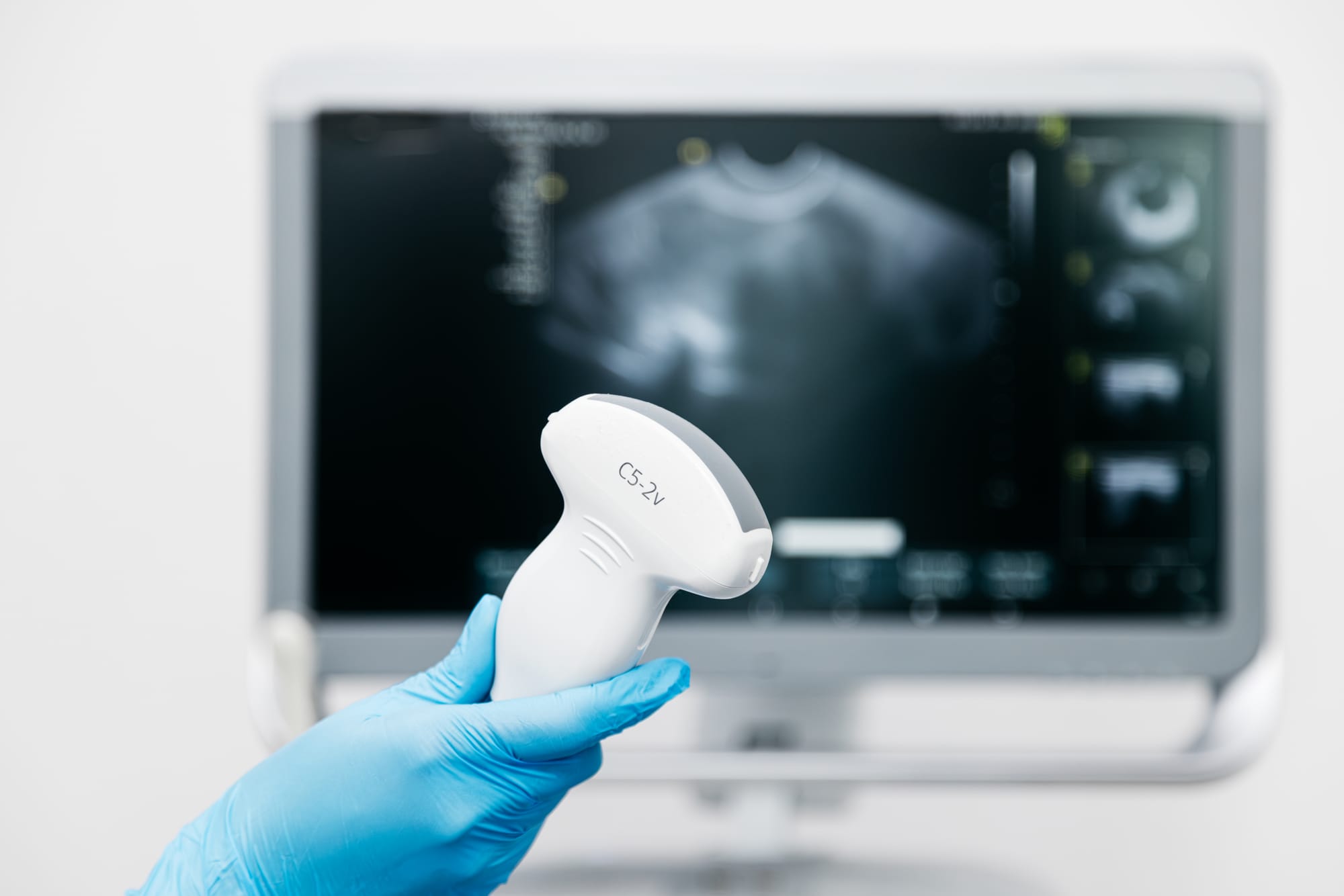 Peri-Procedural Fasting and Gastric Ultrasound Strategies in Glucagon-Like Peptide-1 (GLP-1) Receptor Agonist Users: A Systematic Review With Qualitative Synthesis