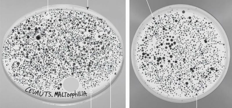 Persistent Multidrug-Resistant Stenotrophomonas maltophilia Bacteraemia After Elective Orthopaedic Surgery in an Immunocompetent Adult
