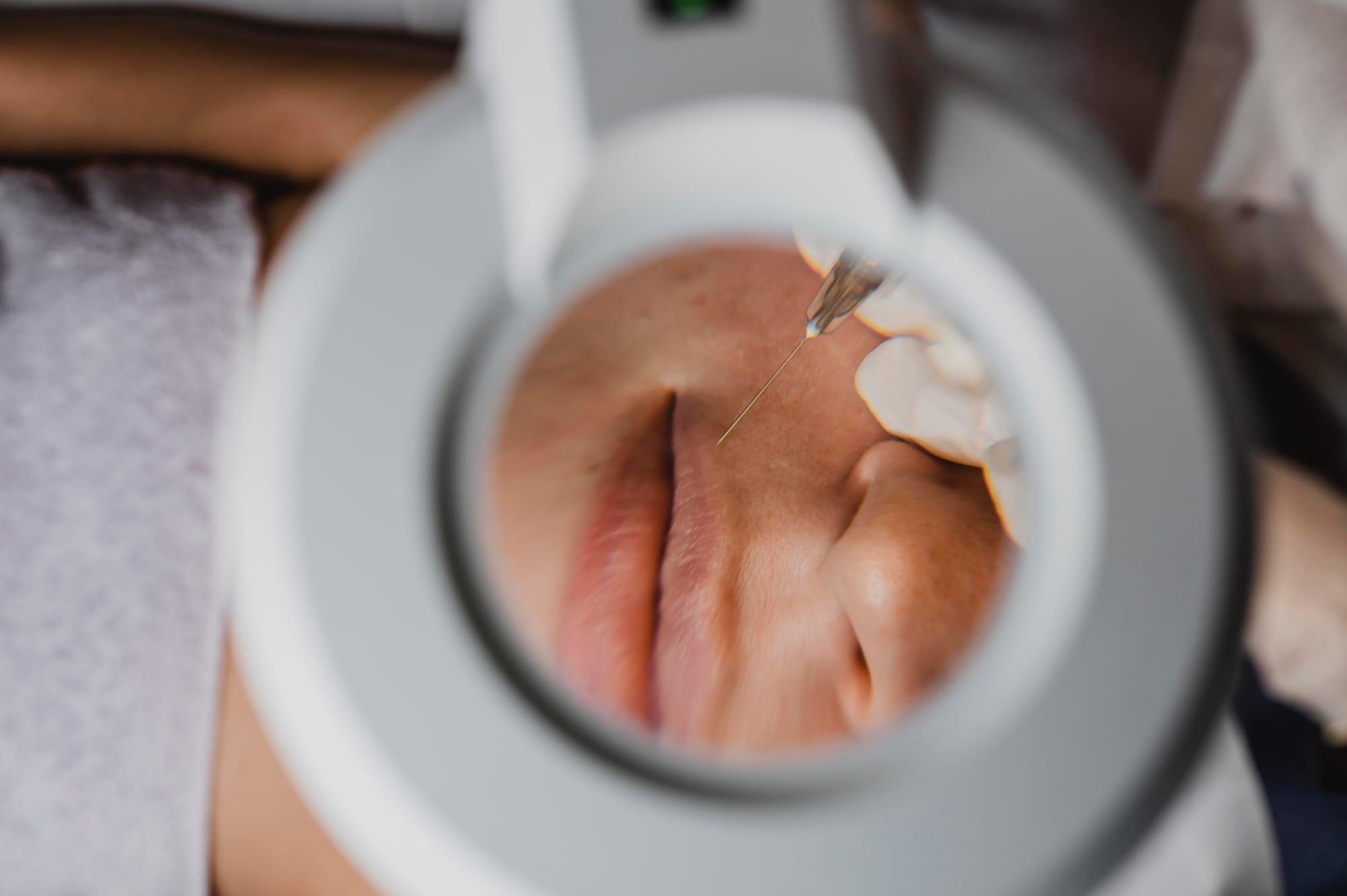 ARMONIZACIÓN OROFACIAL