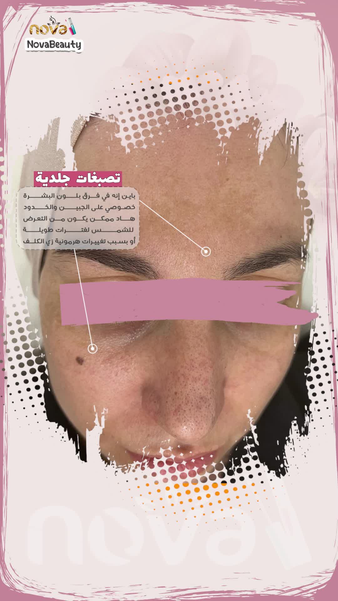 فيديو واحد thumbnail