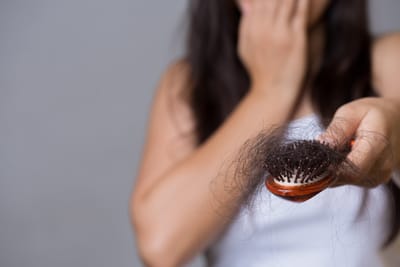Is Hair Transplant a Permanent Solution for Hair Loss?