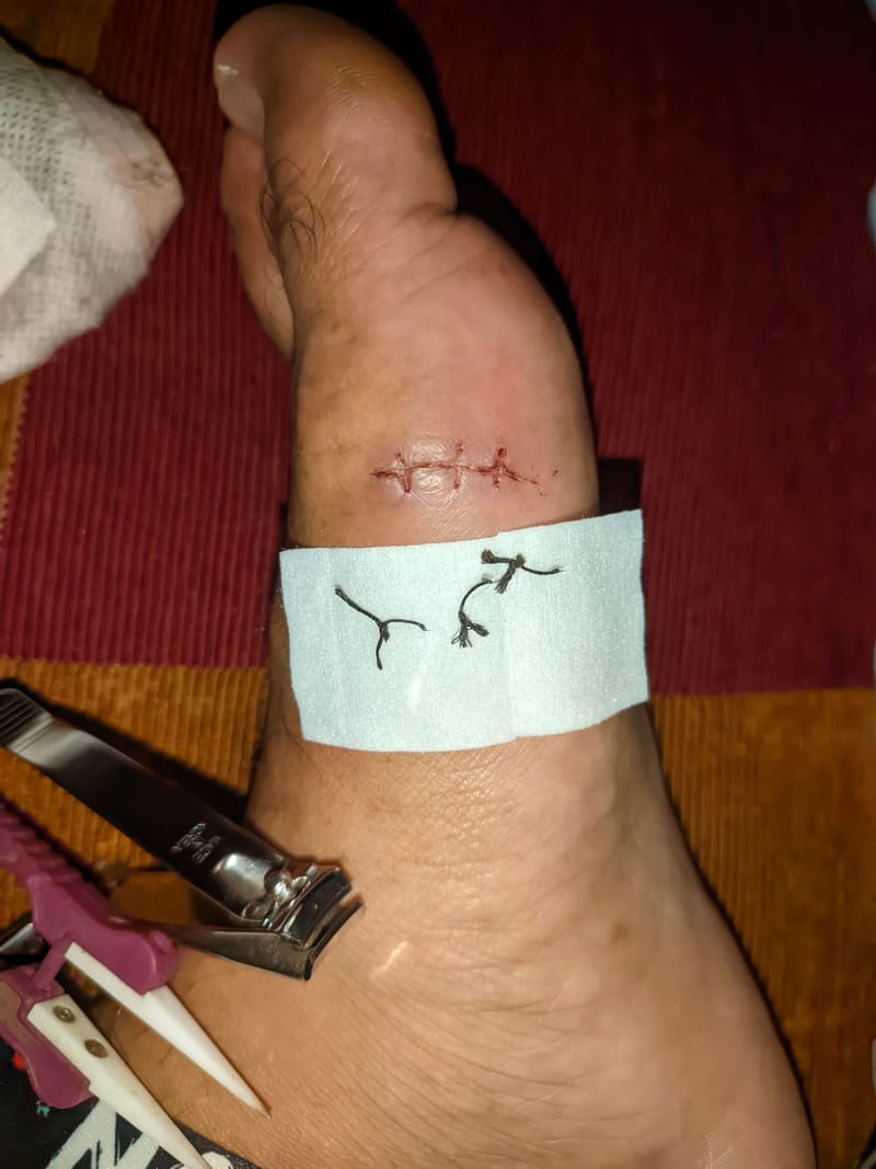 Curativo com Prescrição de Manipulados