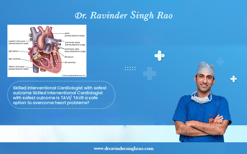 Transcatheter Aortic Valve Replacement
