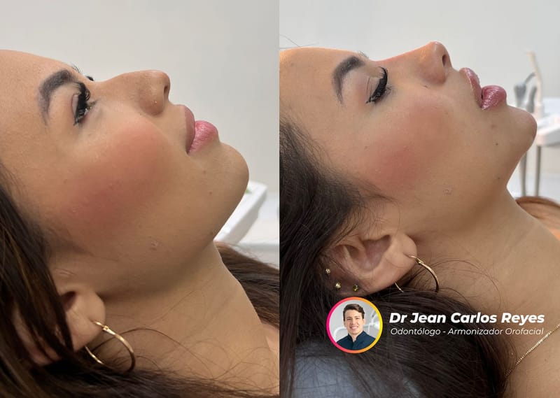 Cómo Instagram y TikTok están cambiando la percepción de la belleza y la autoestima, según el Dr. Jean Carlos Reyes Guerrero