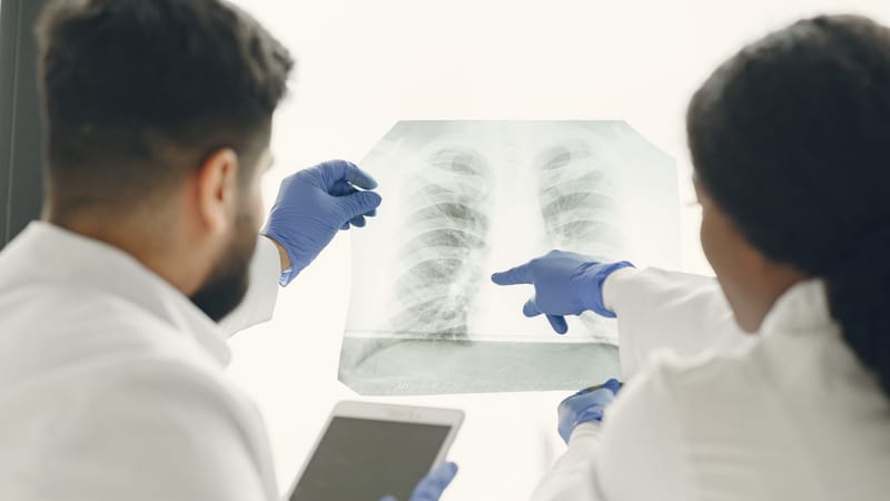 Día Mundial del Cáncer de Pulmón: el diagnóstico oportuno sigue siendo el principal desafío