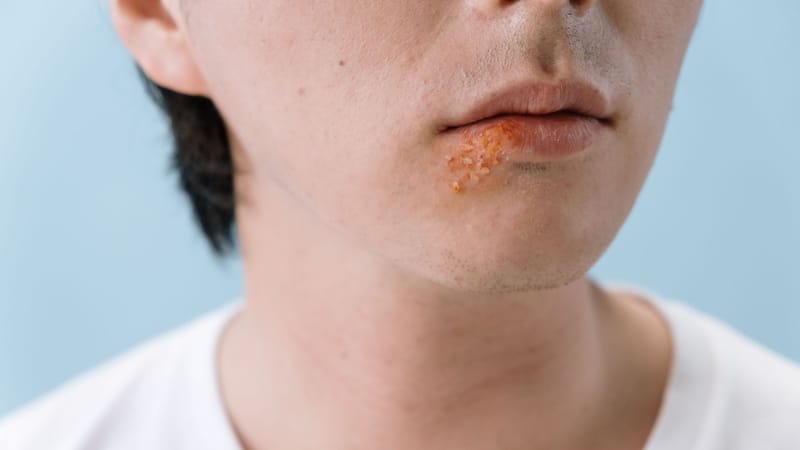 La vacuna del herpes zóster y el mapa del envejecimiento biológico