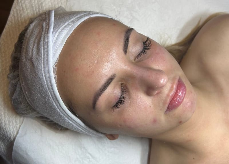 AquaClean Gépi Mélytisztítás Multipoláris Elektroporációval - Megújult Tini Kezelés