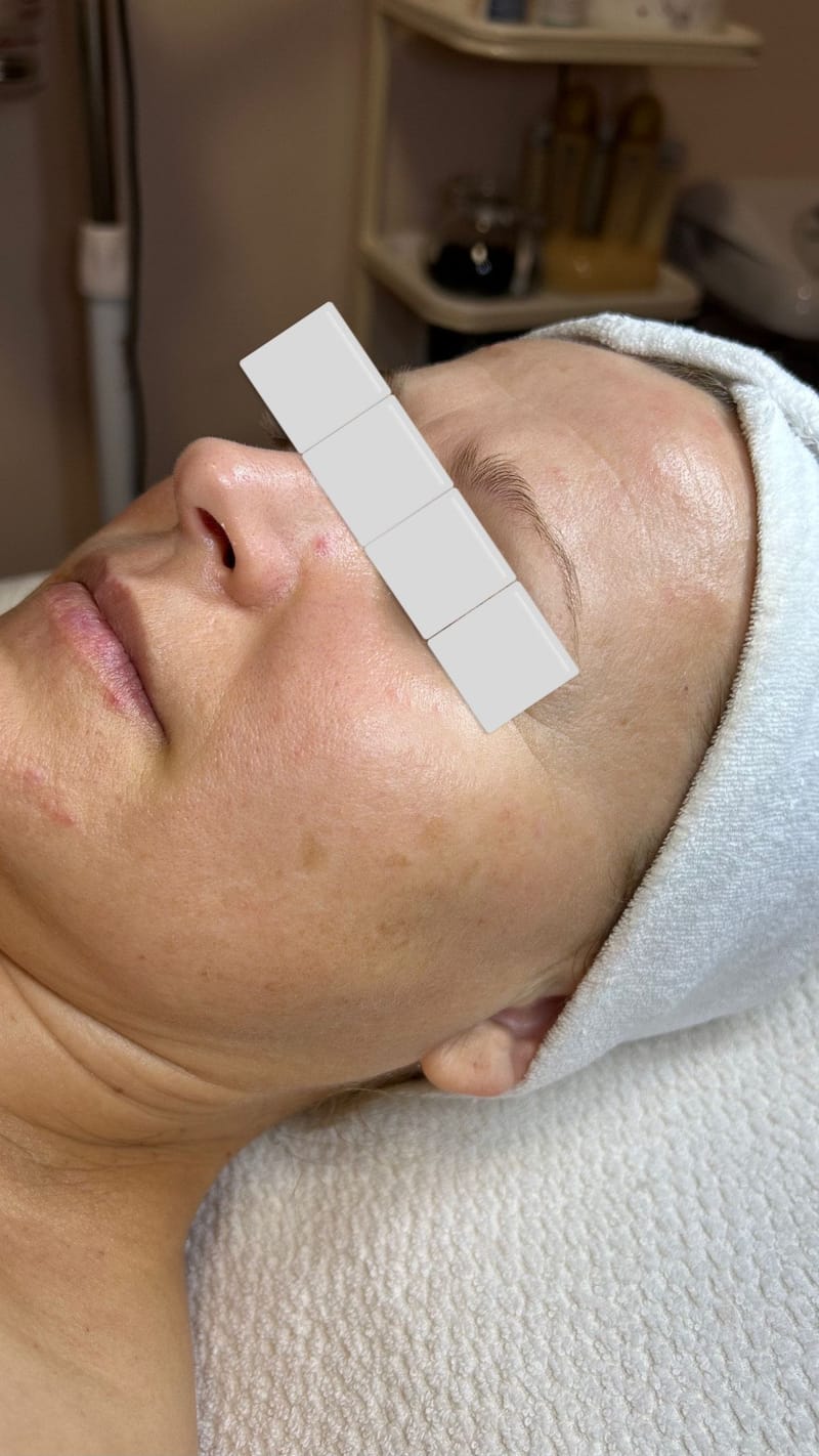 Intenzív Hidratáló - Feszesítő Rituálé