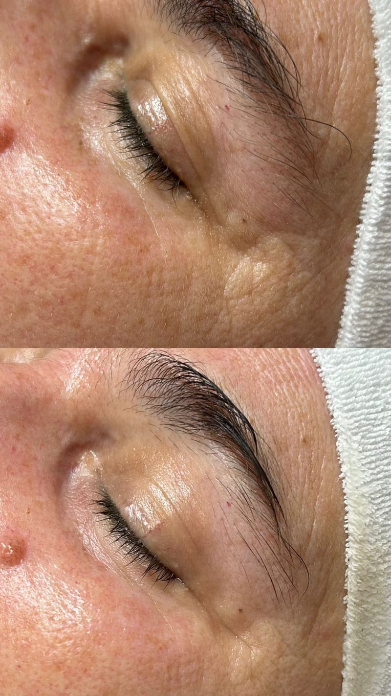 Arkana Eye Complex Care - Szemkörnyék-kezelés