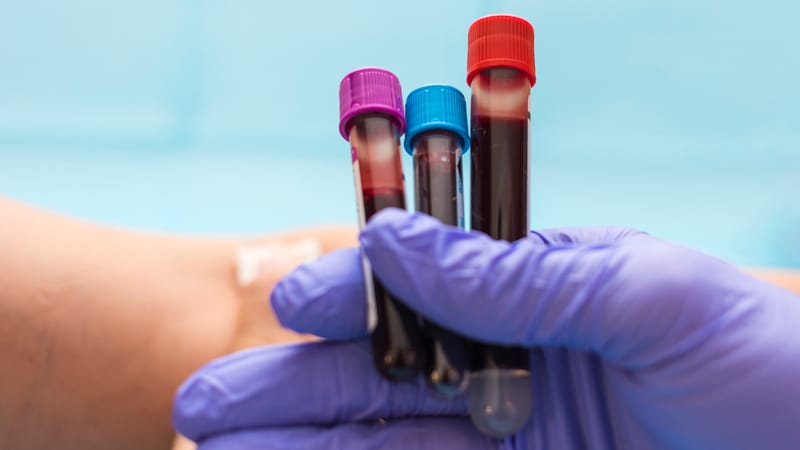 Blood tests – the first step in your training plan