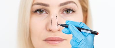 Rhinoplasty: What You Need to Know First