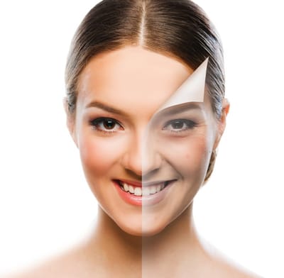 Cosmelan Peel: Improve Skin Texture Easily