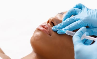 Lip Botox for Lip Line Softening Explained