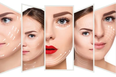 Fotona 4D Facelift Treatment: Ideal for All Skin Types