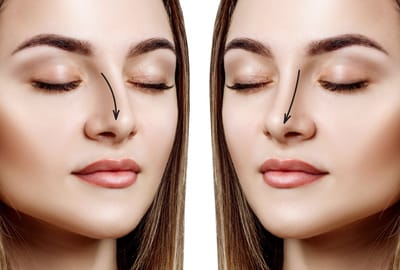 خدمات متكاملة لتجميل الأنف في دبي