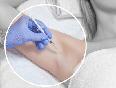 Botox for Hyperhidrosis Hands & Sweat Glands