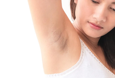Armpit Whitening Secrets Dermatologists Share