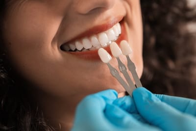 Find Trusted Dental Clinics for Veneers in Dubai