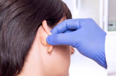 Expert Advice on Ear Reshaping Surgery in Dubai