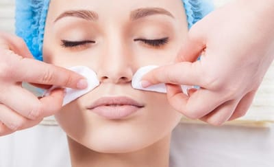 Expert Tips for Chemical Peels in Dubai