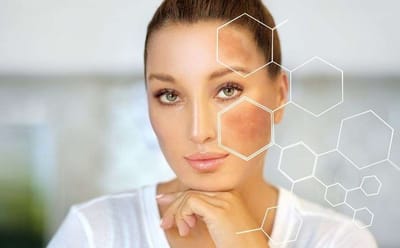Expert Advice for Skin Whitening Treatment in Dubai